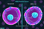 پاورپوینت اثر ژن HER2 و مسیر NF-KB درایجاد سرطان پستان (انگلیسی)