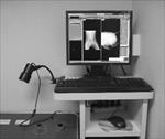 تحقیق-رادیوگرافی-کامپیوتری